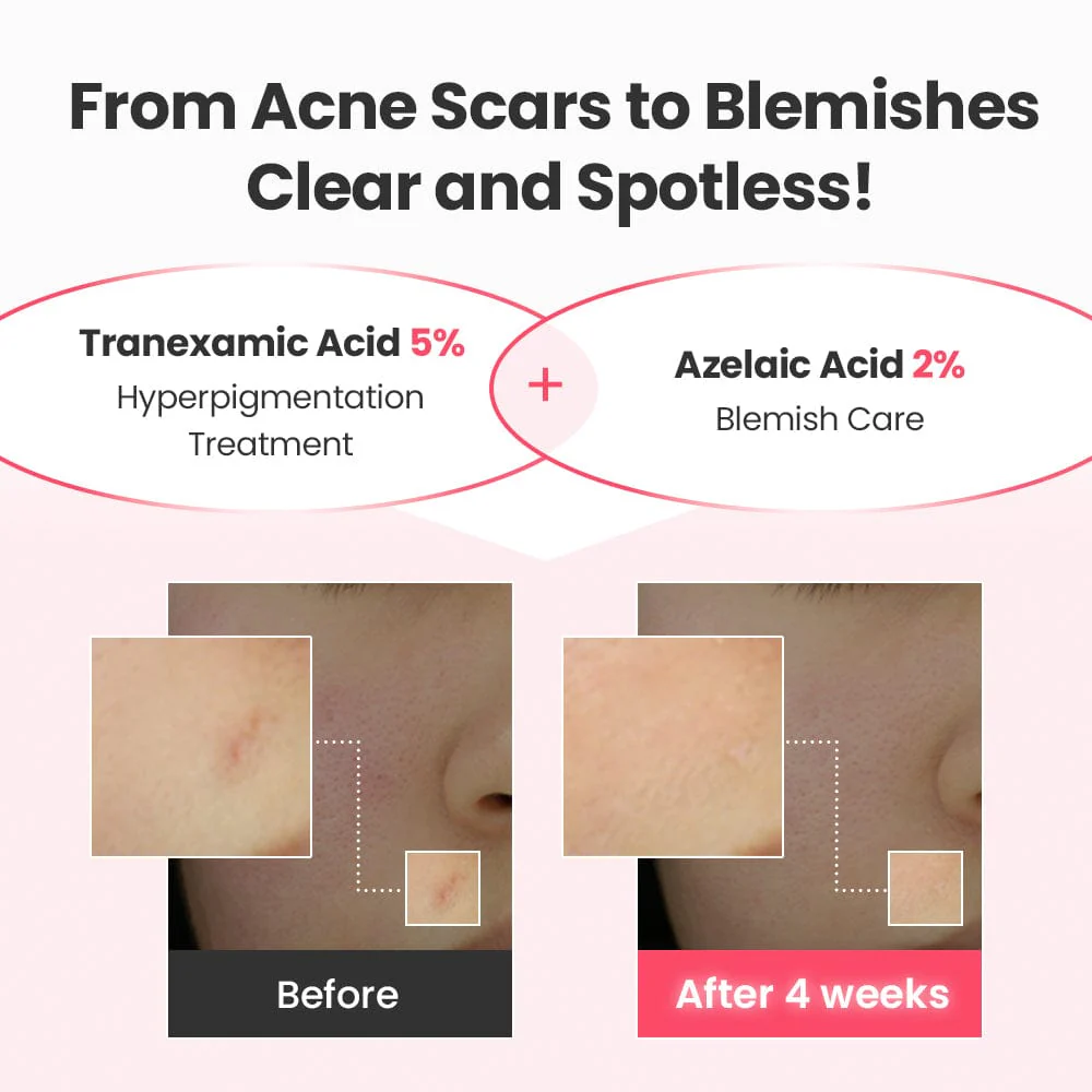 DR.G R.E.D BLEMISH REPAIR SOOTHING SERUM & CREAM DUO - Image 9